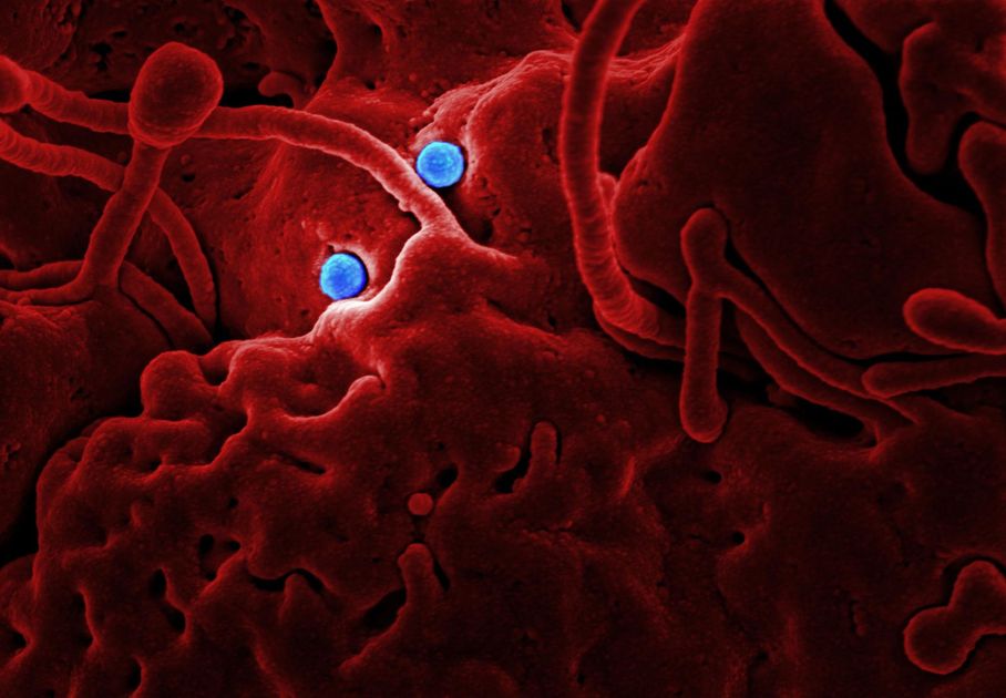 La OMS moviliza USD 518 millones para contener la crisis de ébola en África Central