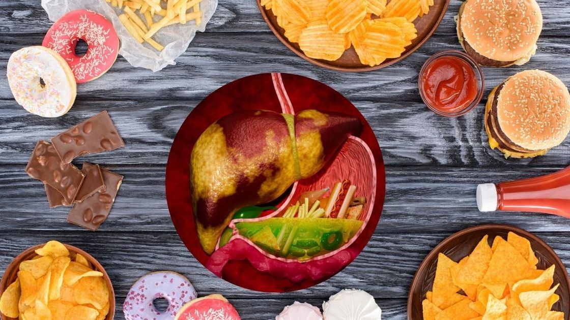 Hígado graso: Cómo revertirlo con hábitos saludables