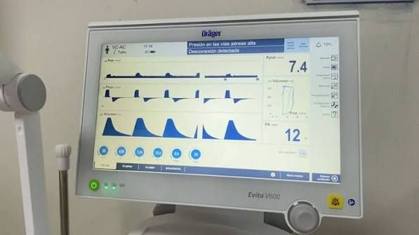 Gobierno de Noboa moderniza UCI del HTMC con tecnología de punta