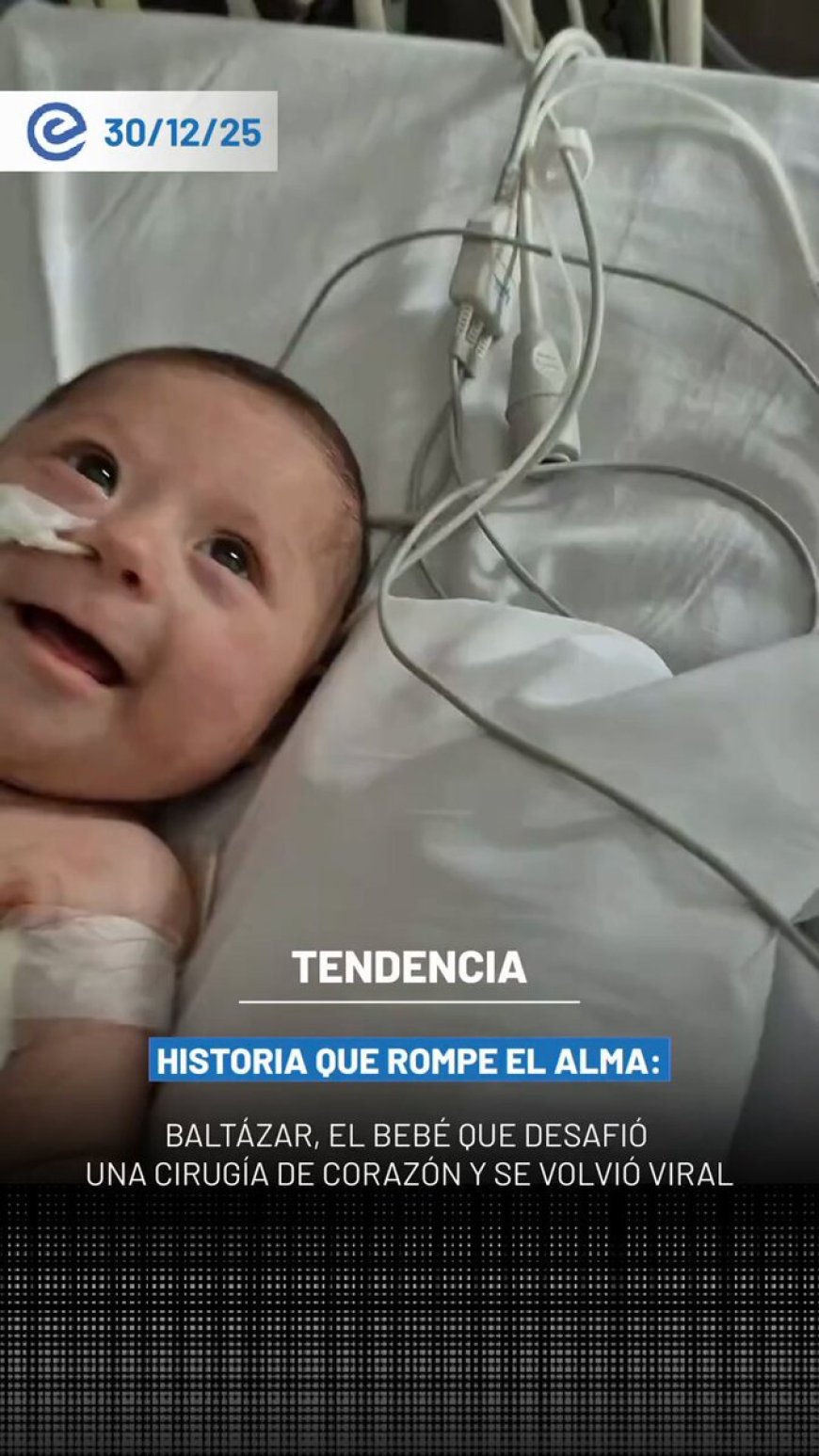 🔵 Un video protagonizado por Baltazar, un bebé de apenas tres meses, se volvió viral tras mostrar su recuperación luego de una compleja cirugía de corazón que conmovió a miles en redes sociales.